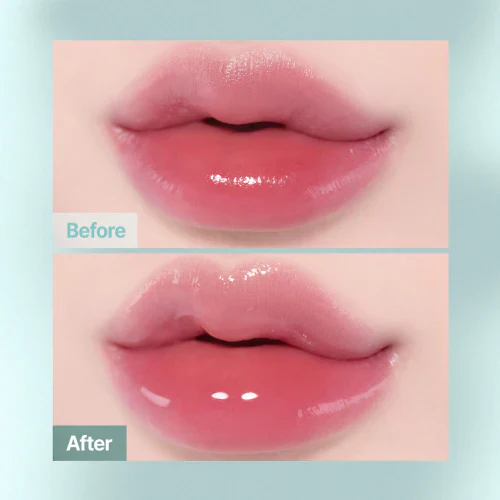 FWEE | 4D Voluming plumper