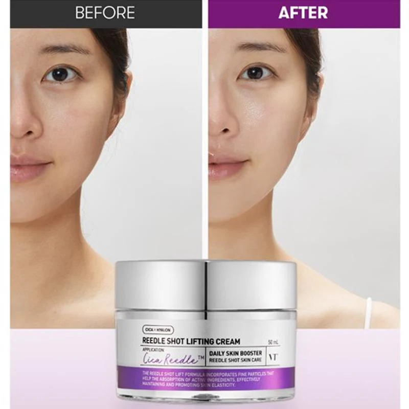 VT COSMETICS | Reedle Shot Lifting Cream – 50ml
